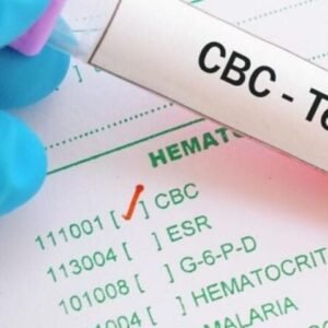 Complete Blood Count (CBC)
