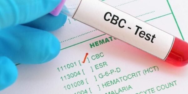 Complete Blood Count (CBC)